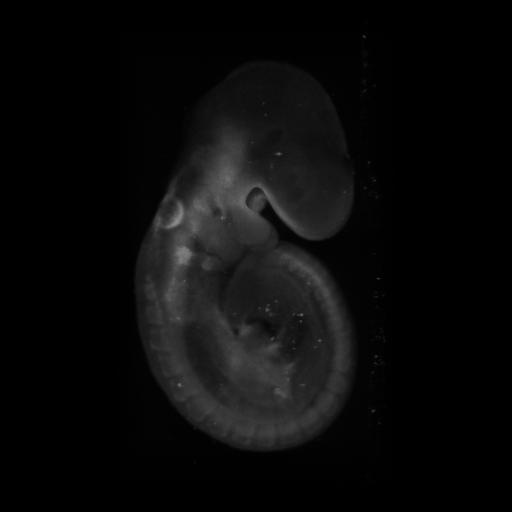3D computer representation of a theiler stage 15 mouse embryo in situ hybridized with a frizzled 7 probe