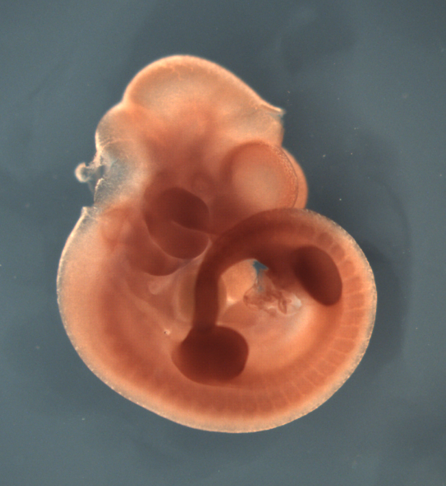 photo of a theiler stage 17 mouse embryo in situ hybridized with a frizzled 7 probe