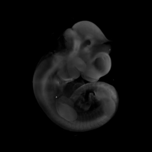 3D computer representation  of a theiler stage 17 mouse embryo in situ hybridized with a frizzled 7 probe