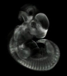 3D reconstruction of the Frizzled 7 gene expression pattern in the theiler stage 19 mouse embryo