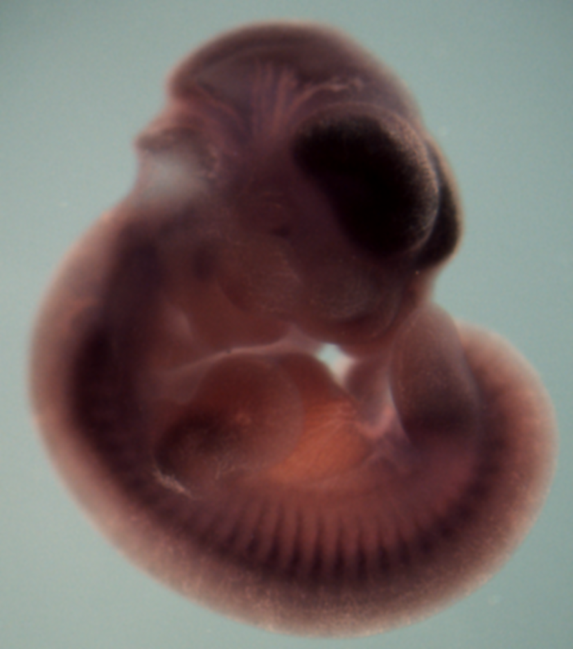 photo of a theiler stage 19 mouse embryo in situ hybridized with a frizzled 8 probe