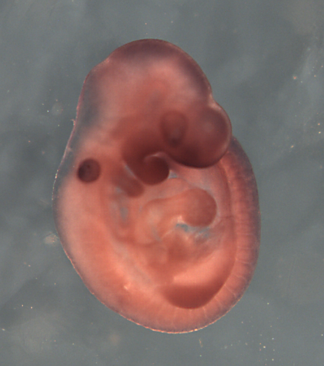 photo of a theiler stage 15 mouse embryo in situ hybridized with a frizzled 8 probe