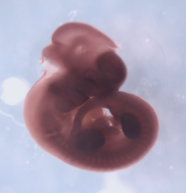 photo of a theiler stage 17 mouse embryo in situ hybridized with a frizzled 8 probe