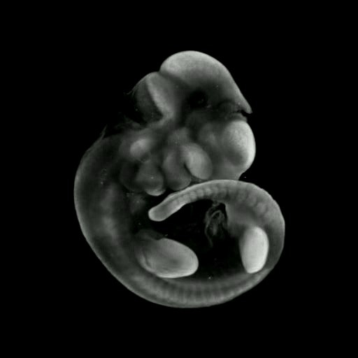 3D computer representation of a theiler stage 17 mouse embryo in situ hybridized with a frizzled 8 probe