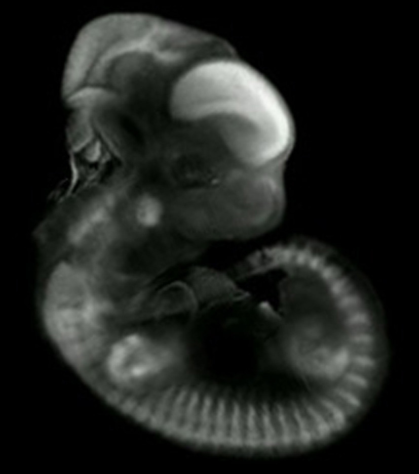 3D computer representation of a theiler stage 19 mouse embryo in situ hybridized with a frizzled 8 probe