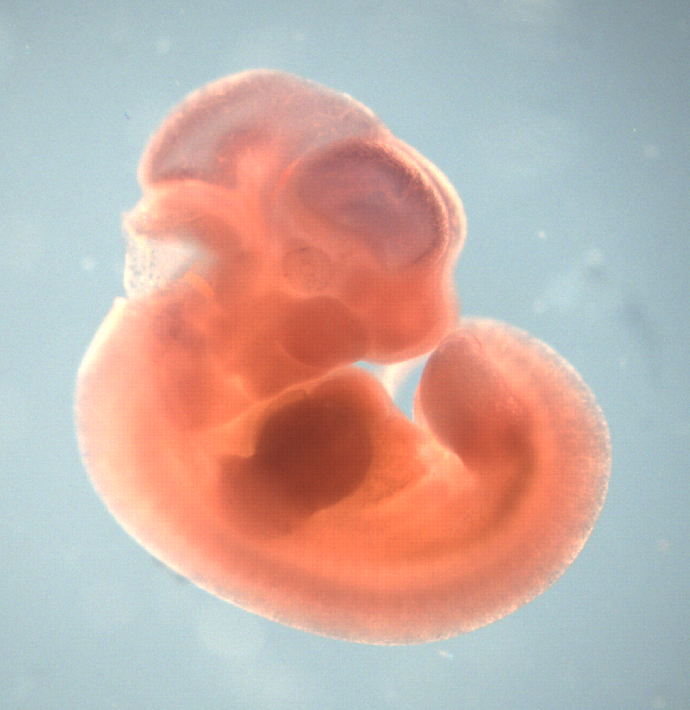 photo of a theiler stage 19 mouse embryo in situ hybridized with a  frizzled 9 probe