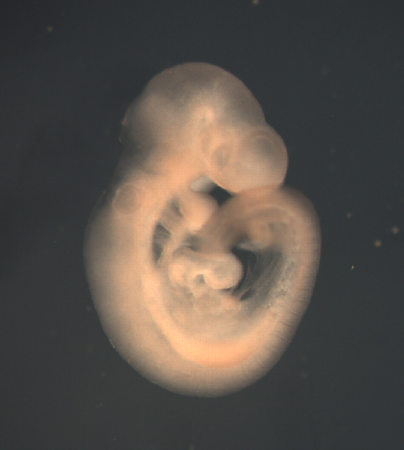 photo of a theiler stage 15 mouse embryo in situ hybridized with a frizzled 9 probe