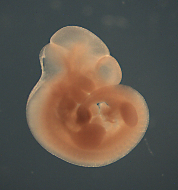 photo of a theiler stage 17 mouse embryo in situ hybridized with a  frizzled 9 probe