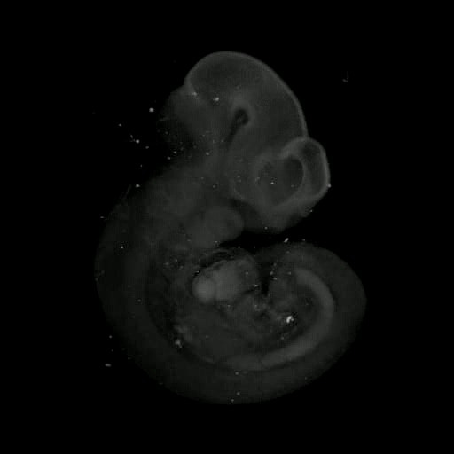 3D computer representation of a theiler stage 17 mouse embryo in situ hybridized with a  frizzled 9 probe
