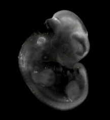 3D computer representation of a theiler stage 19 mouse embryo in situ hybridized with a  frizzled 9 probe