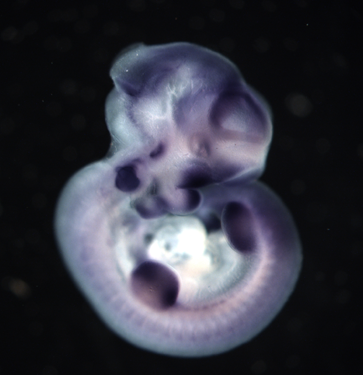 photo of an e10.5 mouse embryo in situ hybridized with a lef1 probe
