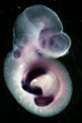 photo of an e9.5 mouse embryo in situ hybridized with a lef1 probe