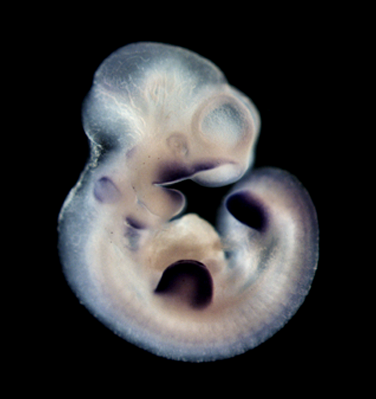 photo of an e10.5 mouse embryo in situ hybridized with a tcf1 probe