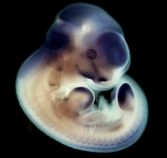 photo of an e11.5 mouse embryo in situ hybridized with a tcf1 probe