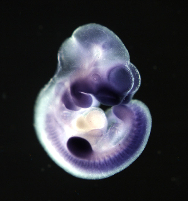 photo of an e10.5 mouse embryo in situ hybridized with a tcf3 probe