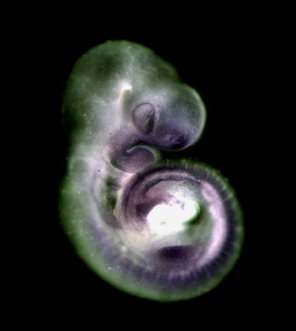 photo of an e9.5 mouse embryo in situ hybridized with a tcf3 probe