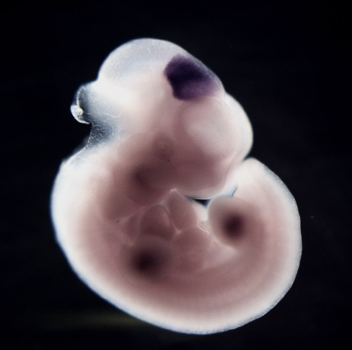 photo of an e11.5 mouse embryo in situ hybridized with a tcf4 probe