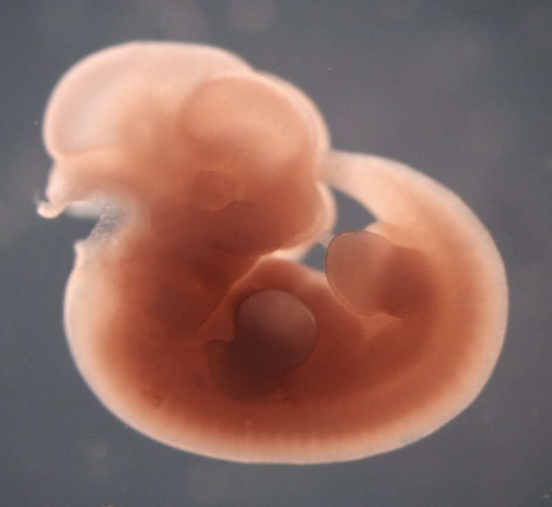 photo of a theiler stage 19 mouse embryo in situ hybridized with a wnt 10a probe
