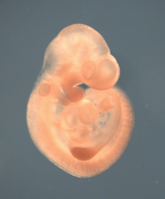 photo of a theiler stage 15 mouse embryo in situ hybridized with a wnt 10a probe