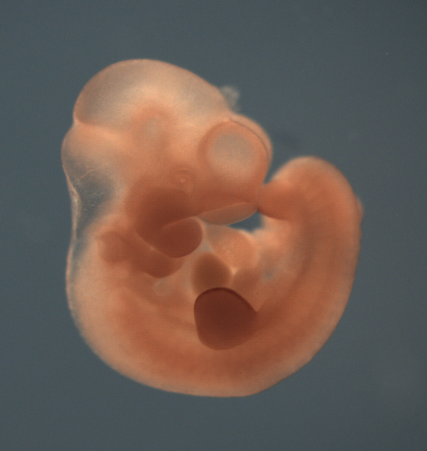 photo of a theiler stage 17 mouse embryo in situ hybridized with a wnt 10a probe