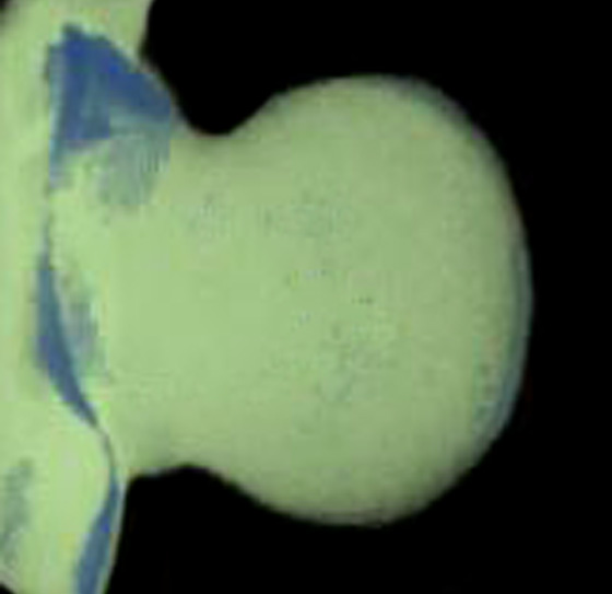 3D computer representation of a theiler stage 19 mouse embryo forelimb in situ hybridized with a wnt 10b probe