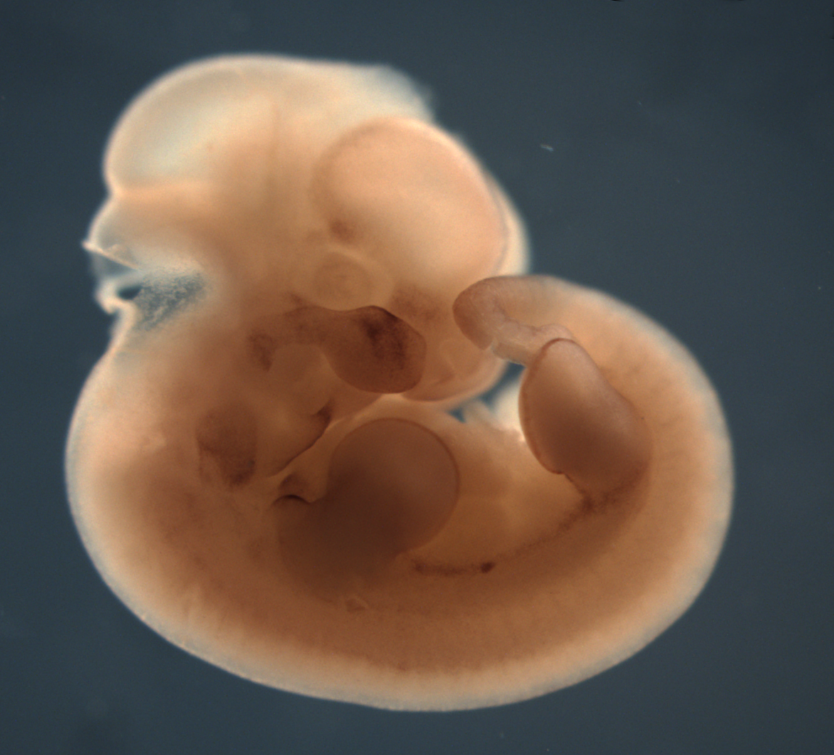 photo of a theiler stage 19 mouse embryo in situ hybridized with a wnt 10b probe
