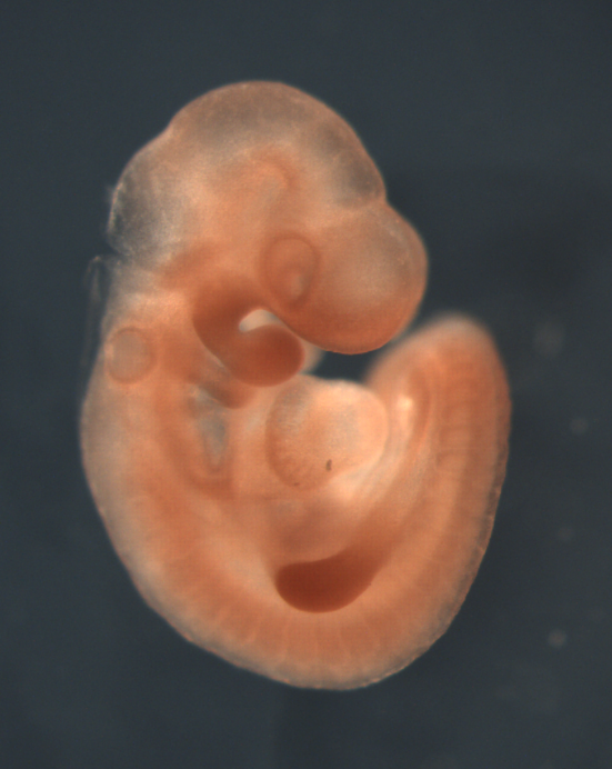 photo of a theiler stage 15 mouse embryo in situ hybridized with a wnt 10b probe