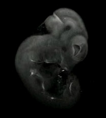 3D computer representation of a theiler stage 19 mouse embryo in situ hybridized with a wnt 10b probe