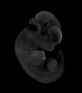 3D computer representation of a theiler stage 19 mouse embryo in situ hybridized with a wnt 10a probe