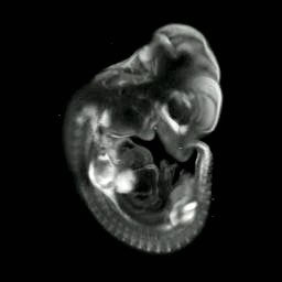 3D computer reconstruction of a mouse embryo in situ hybridized with a Wnt 11 probe, side view