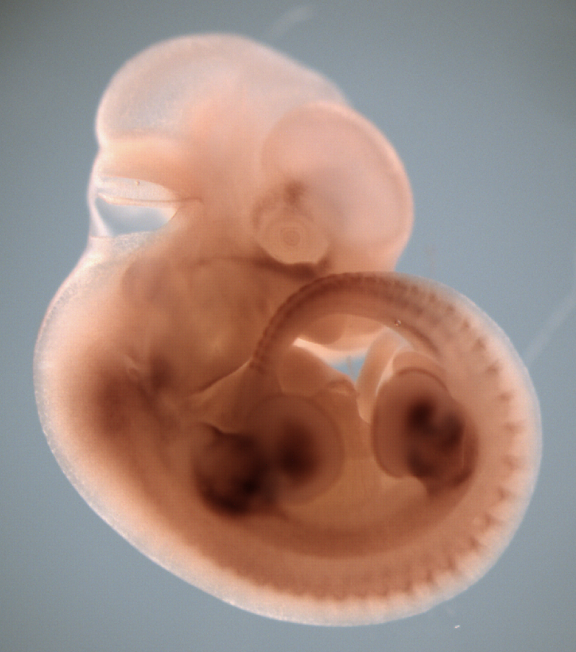 photo of a theiler stage 19 mouse embryo in situ hybridized with a wnt 11 probe