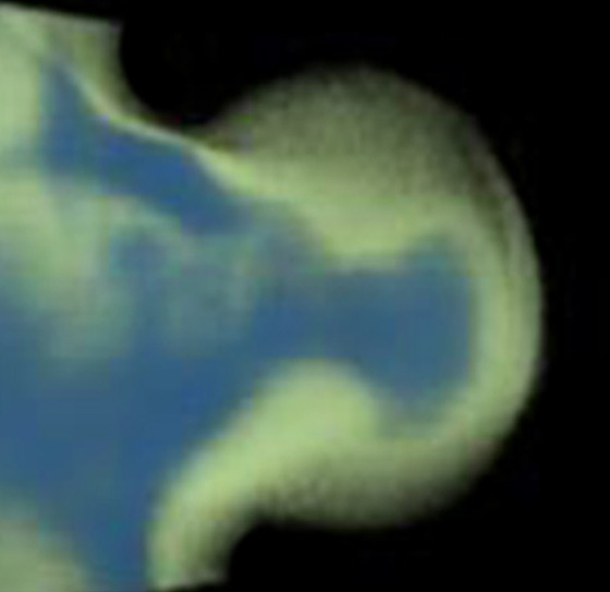 3D computer representation of a theiler stage 19 mouse embryo forelimb in situ hybridized with a wnt 11 probe