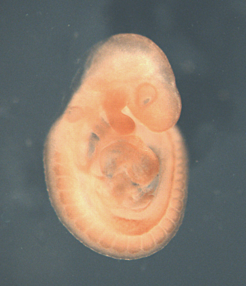 photo of a theiler stage 15 mouse embryo in situ hybridized with a wnt 11 probe