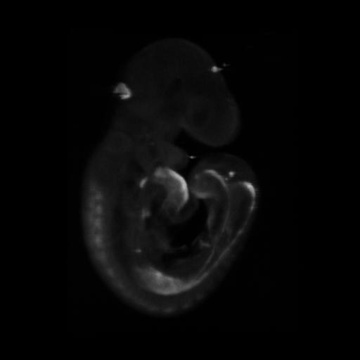 3D computer representation of a theiler stage 15 mouse embryo in situ hybridized with a wnt 11 probe