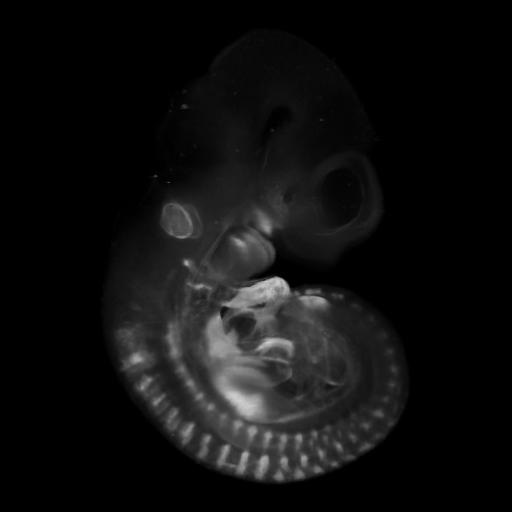 3D computer representation of a theiler stage 17 mouse embryo in situ hybridized with a wnt 11 probe