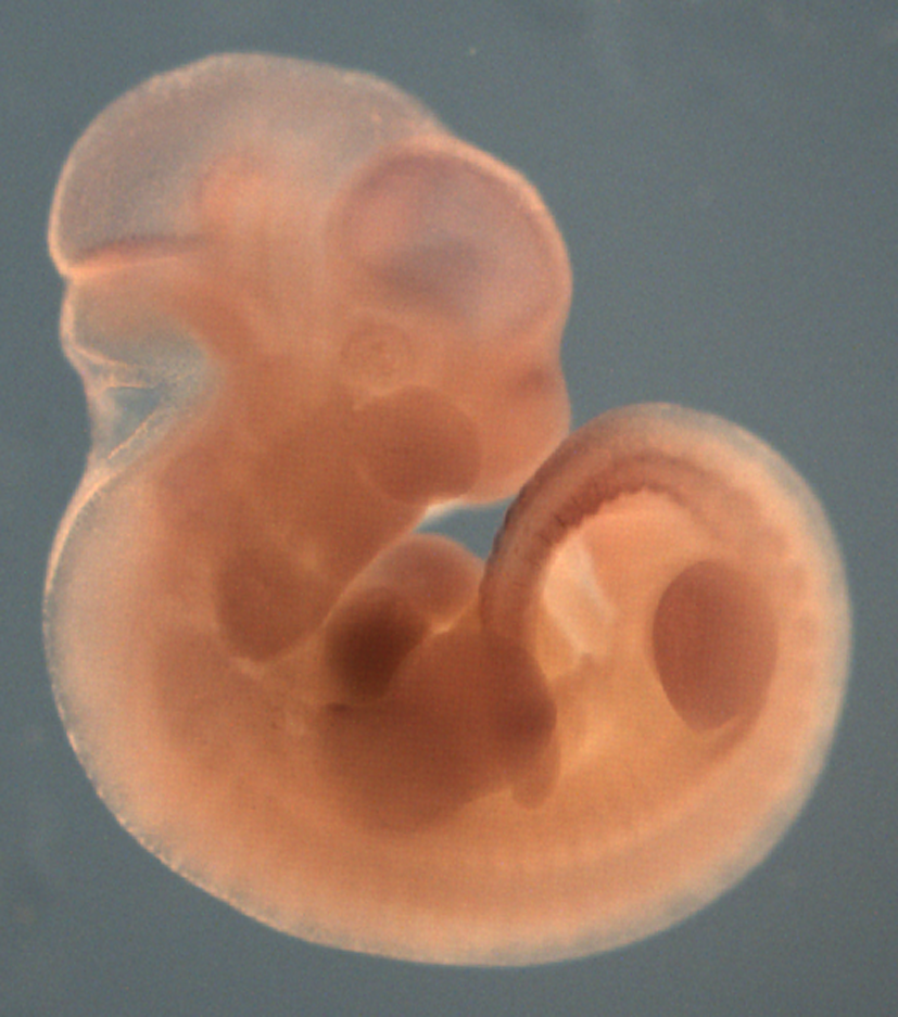 photo of a theiler stage 19 mouse embryo in situ hybridized with a wnt 16 probe