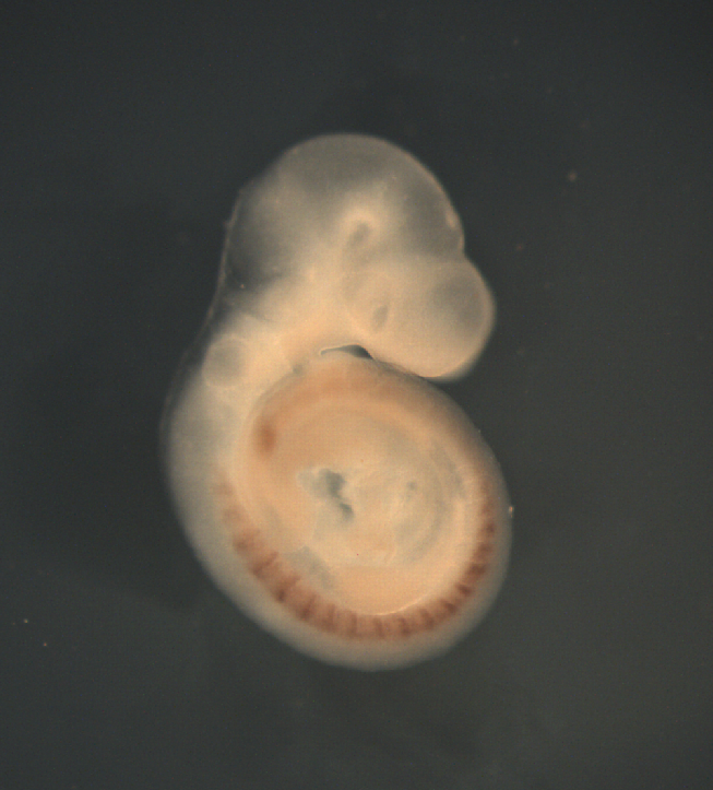 photo of a theiler stage 15 mouse embryo in situ hybridized with a wnt 16 probe