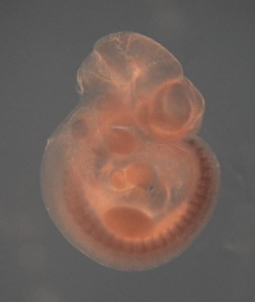 photo of a theiler stage 17 mouse embryo in situ hybridized with a wnt 16 probe