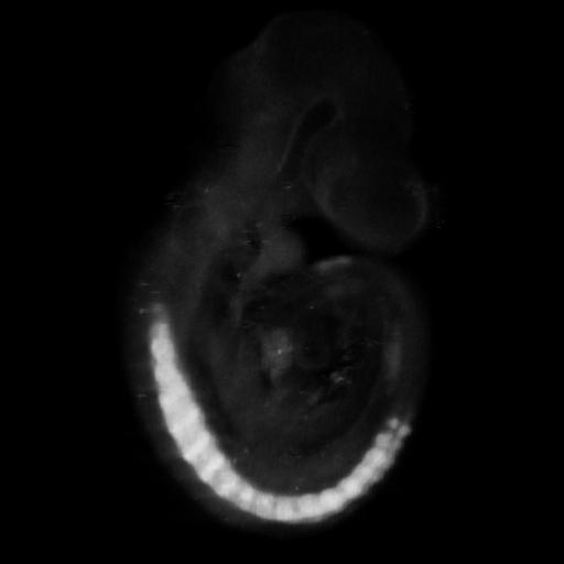 3D computer representation of a theiler stage 15 mouse embryo in situ hybridized with a wnt 16 probe