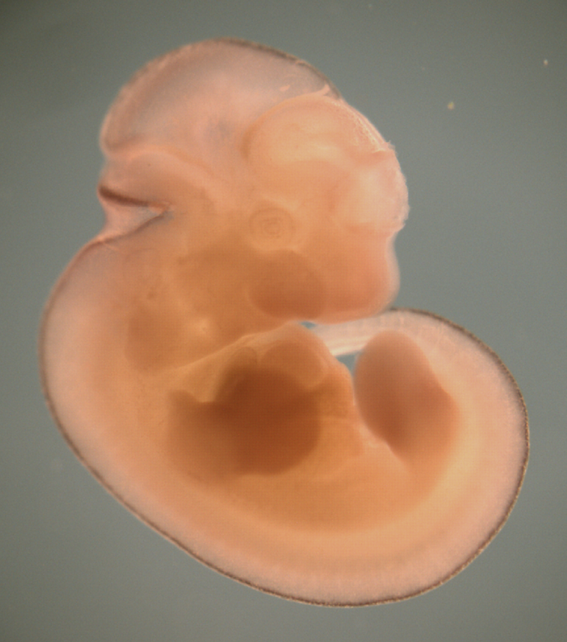photo of a theiler stage 19 mouse embryo in situ hybridized with a wnt1 probe