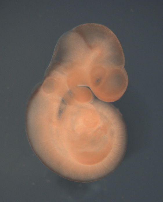 photo of a theiler stage 15 mouse embryo in situ hybridized with a wnt1 probe