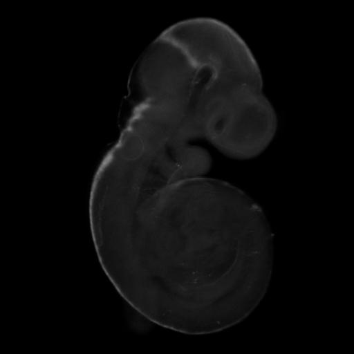 3D computer representation of a theiler stage 15 mouse embryo in situ hybridized with a wnt1 probe