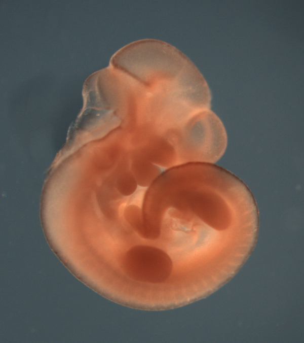 photo of a theiler stage 17 mouse embryo in situ hybridized with a wnt1 probe