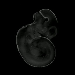 3D computer representation of a theiler stage 17 mouse embryo in situ hybridized with a wnt1 probe