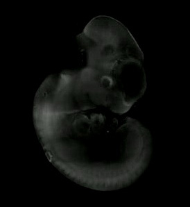 3d computer reconstruction of a mouse embryo in situ hybridized with a wnt 2b probe