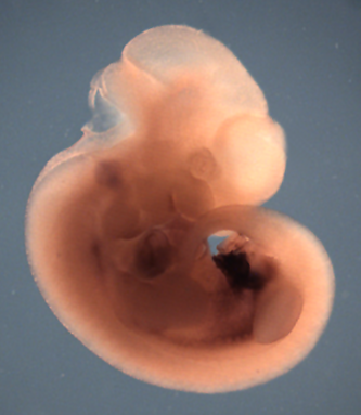 photo of a theiler stage 19 mouse embryo in situ hybrdized with a wnt 2 probe
