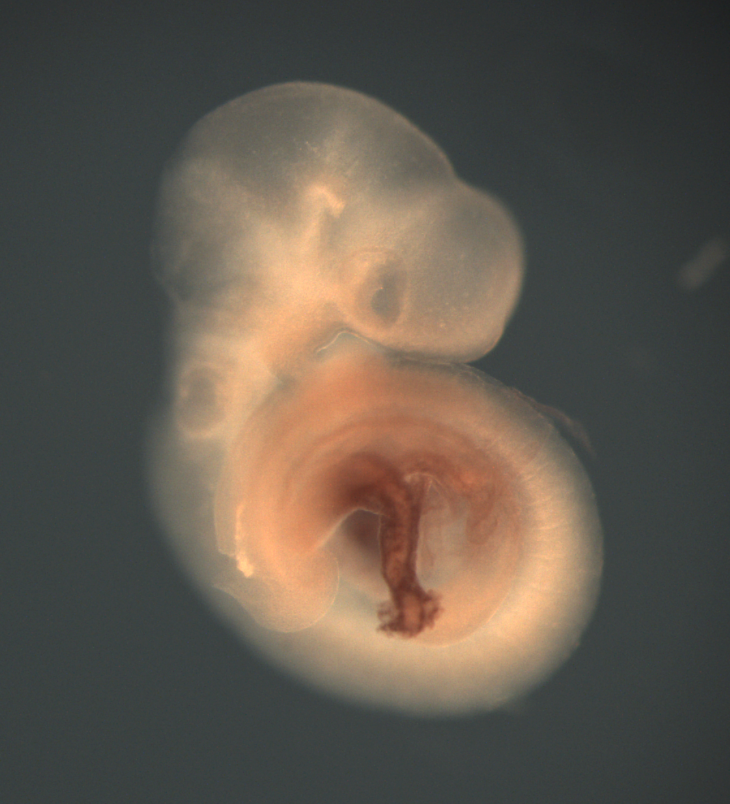 photo of a theiler stage 15 mouse embryo in situ hybrdized with a wnt 2 probe