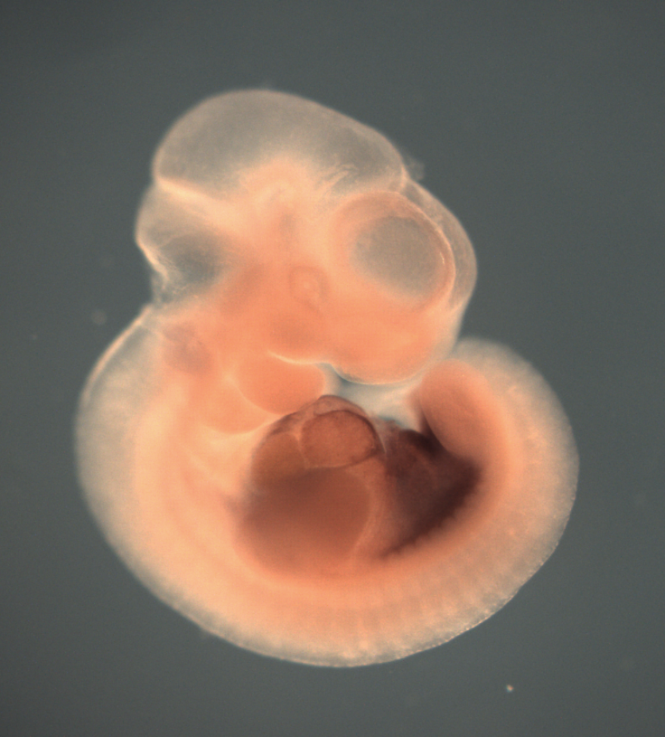 photo of a theiler stage 17 mouse embryo in situ hybrdized with a wnt 2 probe