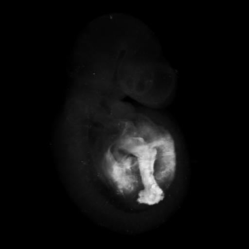3D computer representation of a theiler stage 15 mouse embryo in situ hybrdized with a wnt 2 probe