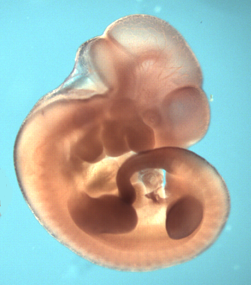 photo of a theiler stage 19 mouse embryo in situ hybridized with a Wnt3A probe